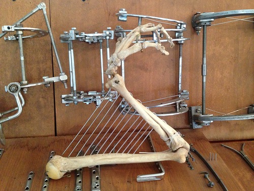 Доктор Кудзаев изготовил из скелета человеческой руки двенадцатиструнную арфу