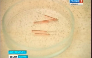 40 азы сæххæст Цæгат Ирыстоны рефлексотерапийы службæйыл