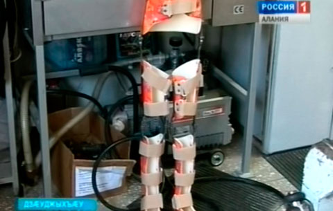 Дзæуджыхъæуы протезтæ кæнæн ортопедон центры куыстæй чидæртæ разы не сты